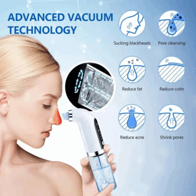 Electric Blackhead Remover for deep-cleaned, healthy skin